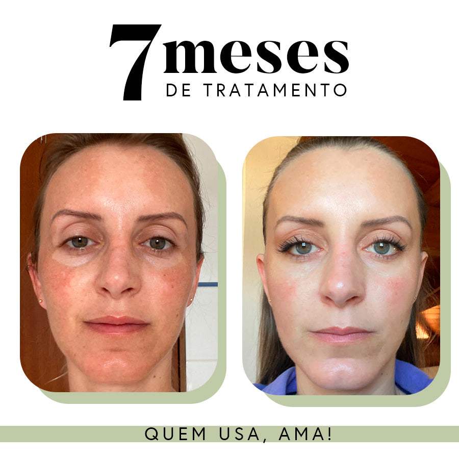 Imagem do produto 7